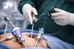 Endomechanical & Stappling