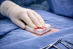 Hemostasis & Bleeding Control