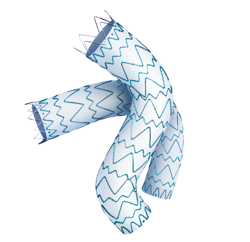 Tycheseal™ TAA Stent Graft System